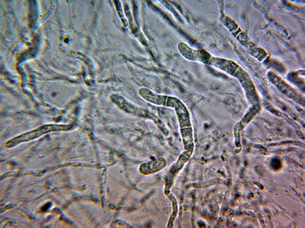 Un corticale ceroso da identificare